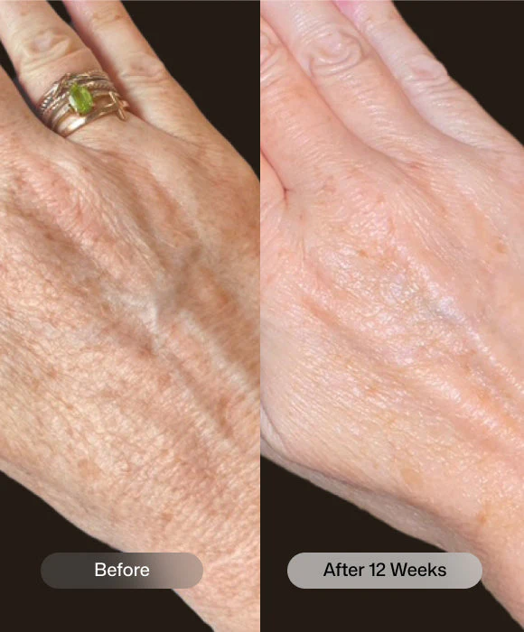 YouthFull Hands™ - Image 5